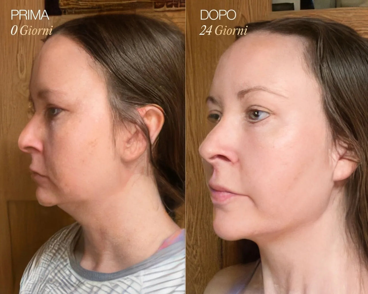 Spazzola Viso Linfodrenante