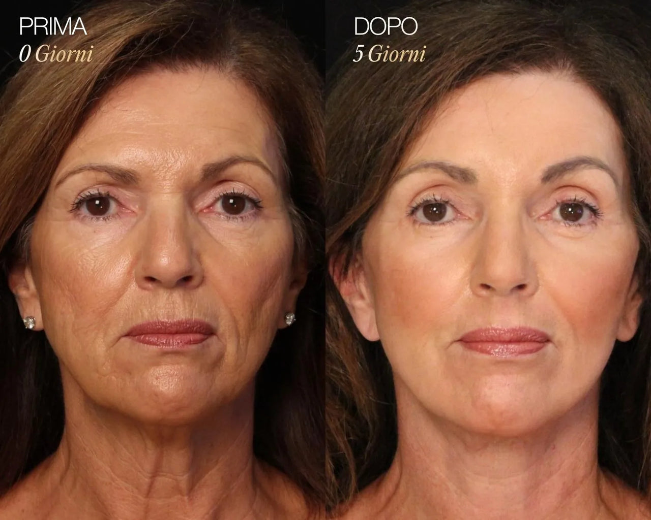 Spazzola Viso Linfodrenante